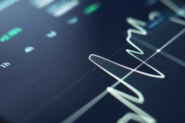 腾讯云：以AI与全球化构筑新增长极